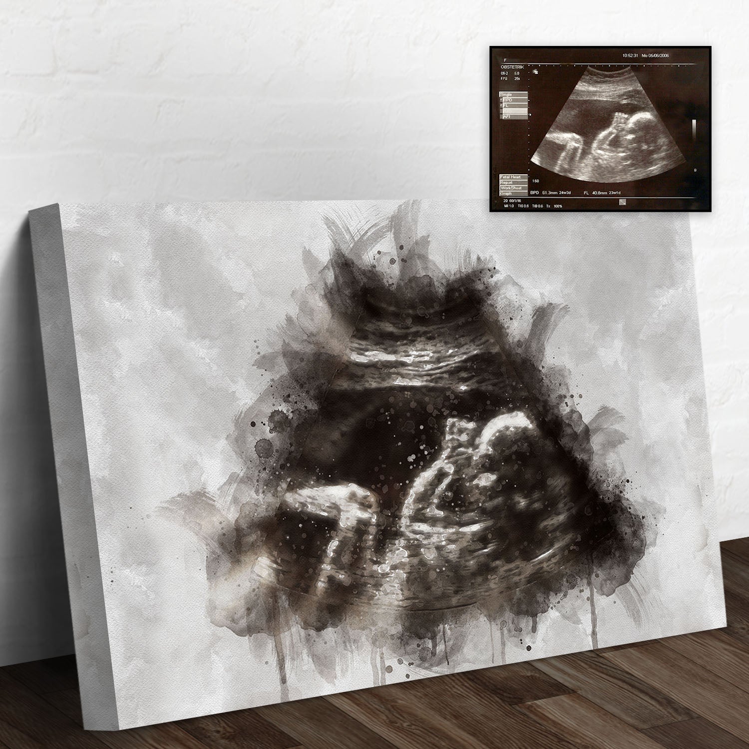 Custom Baby Ultrasound Watercolor Portrait on sale at MyriadMart